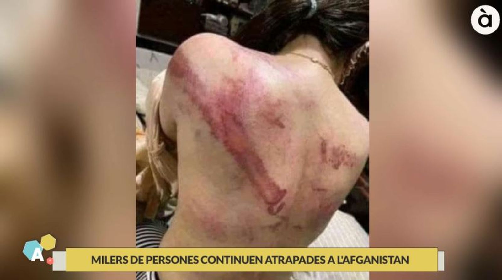 Imatge rebuda (febrer 2022) d'una pallissa a una dona per reivindicar els drets de les dones