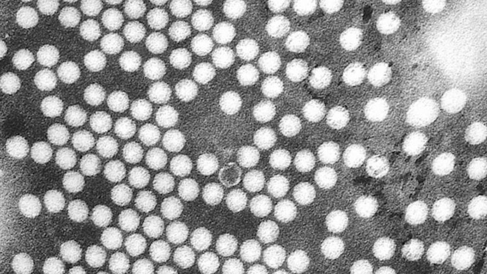 Afectats per la poliomielitis reclamen que Sanitat reprenga el protocol d\'atenció integral