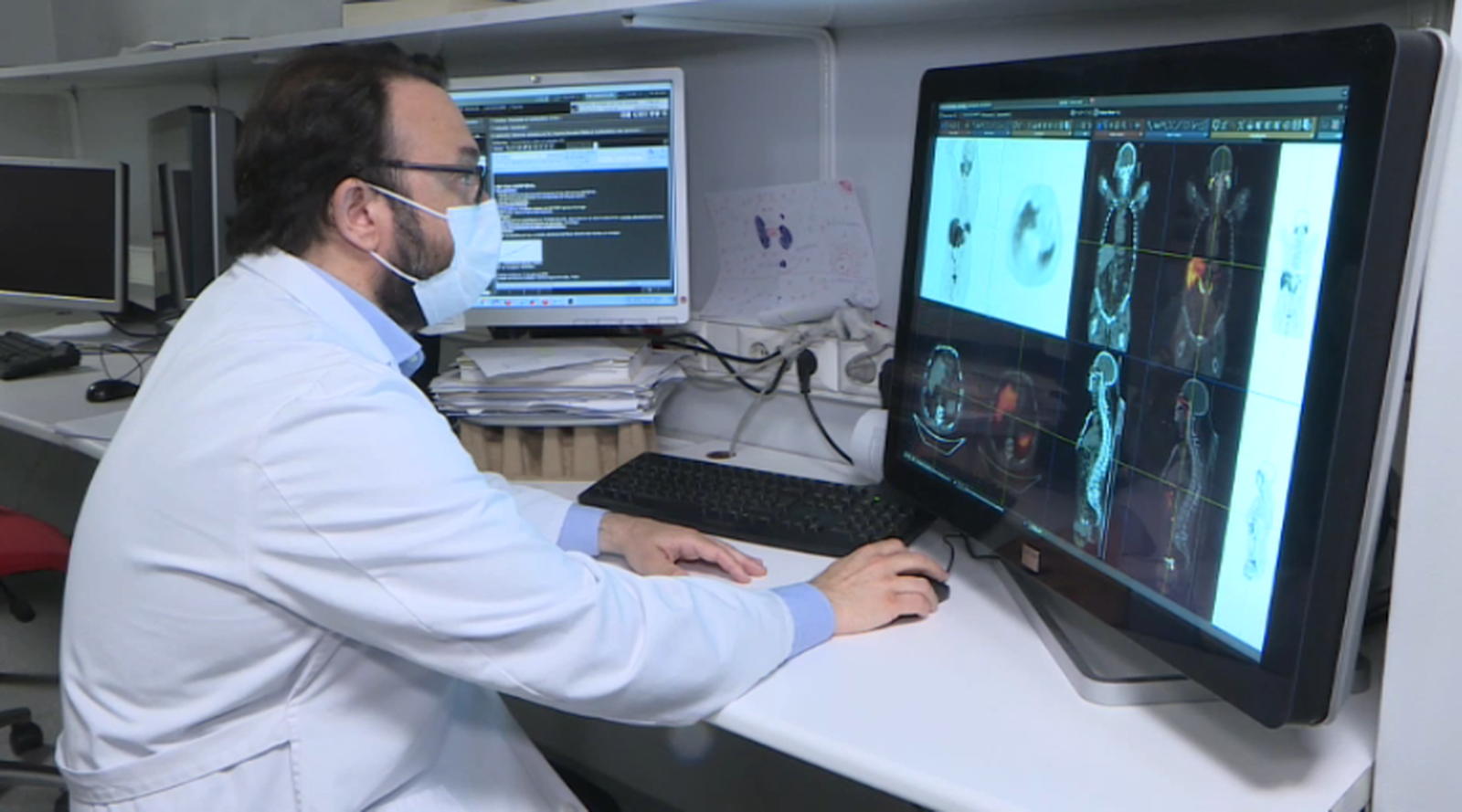 Pablo Sopena, cap de Medicina Nuclear de l’hospital Vithas Valencia 9 d'octubre