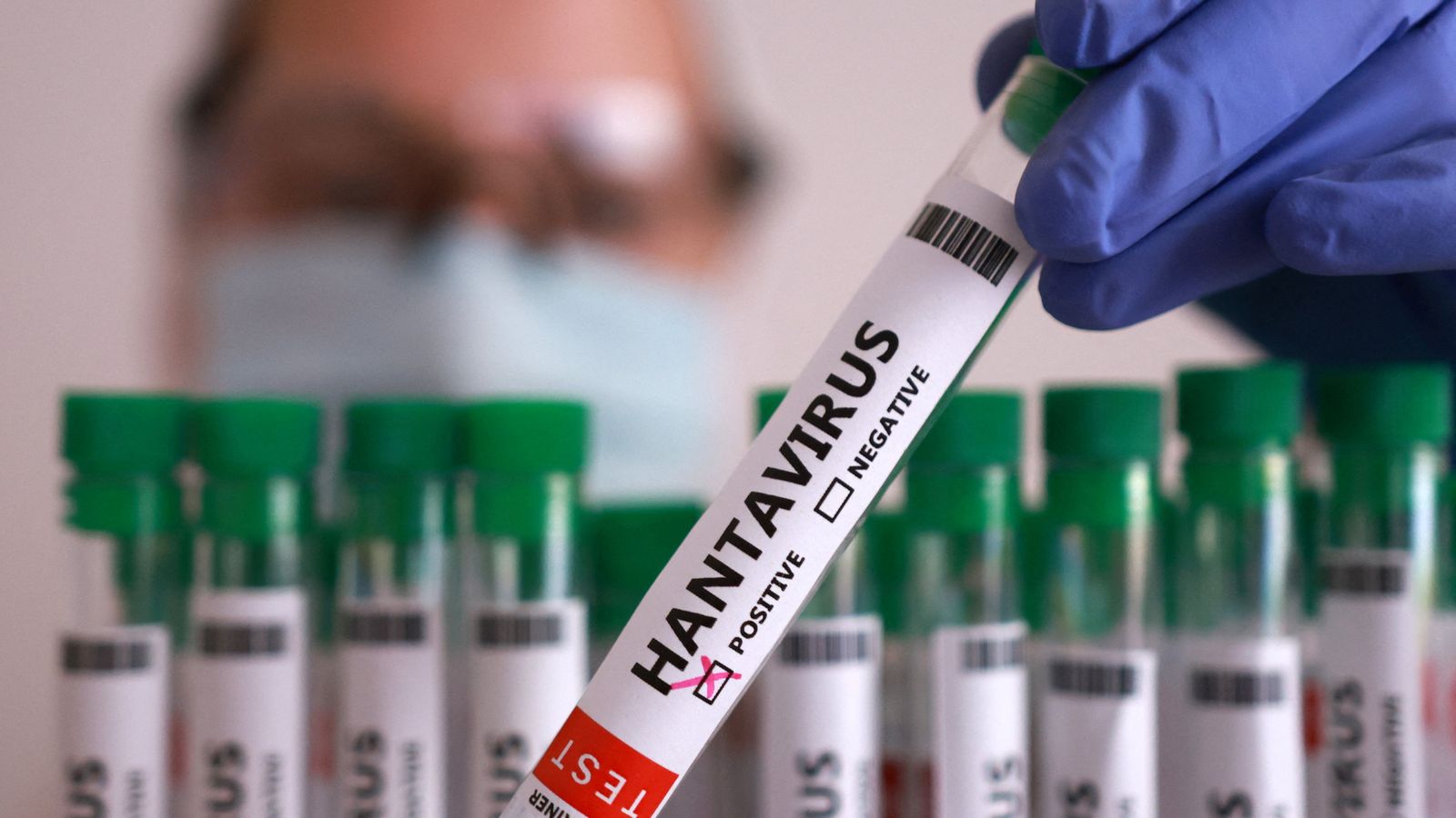 Imatge d'una prova diagnòstica d'hantavirus