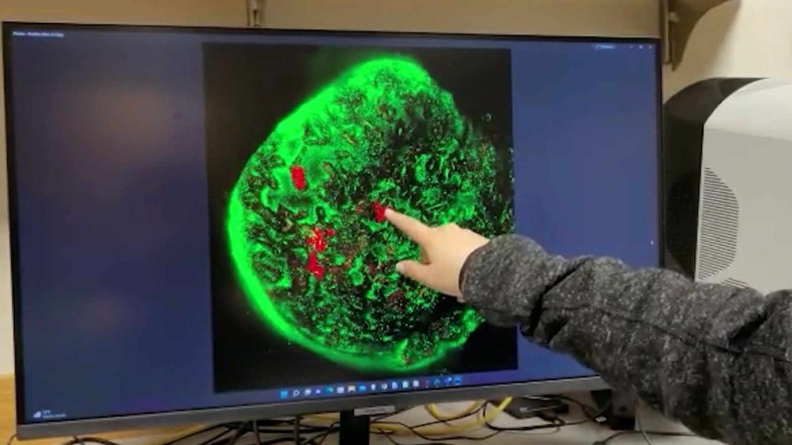 Detecció de cèl·lules cancerígenes