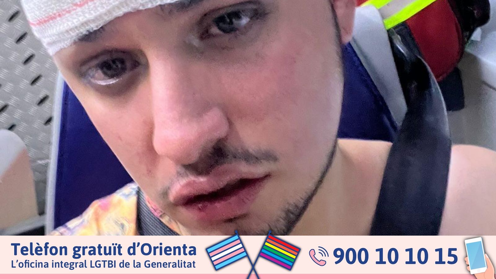 Astra no pot tancar la mandíbula a conseqüència de les constusions