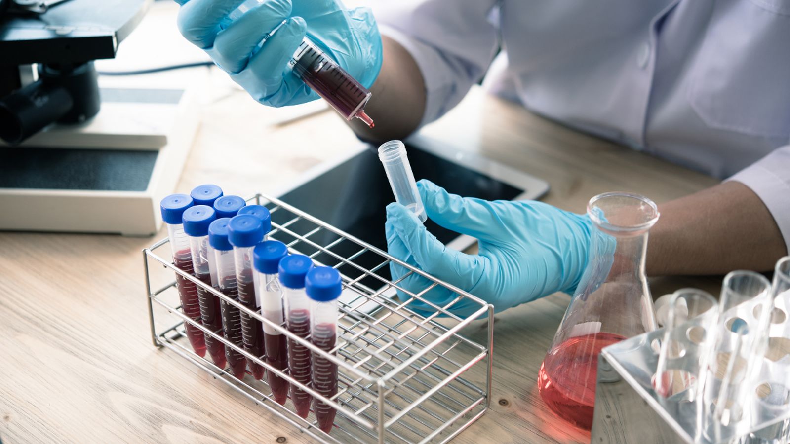 El coronavirus se sent "particularment atret" pel grup sanguini A