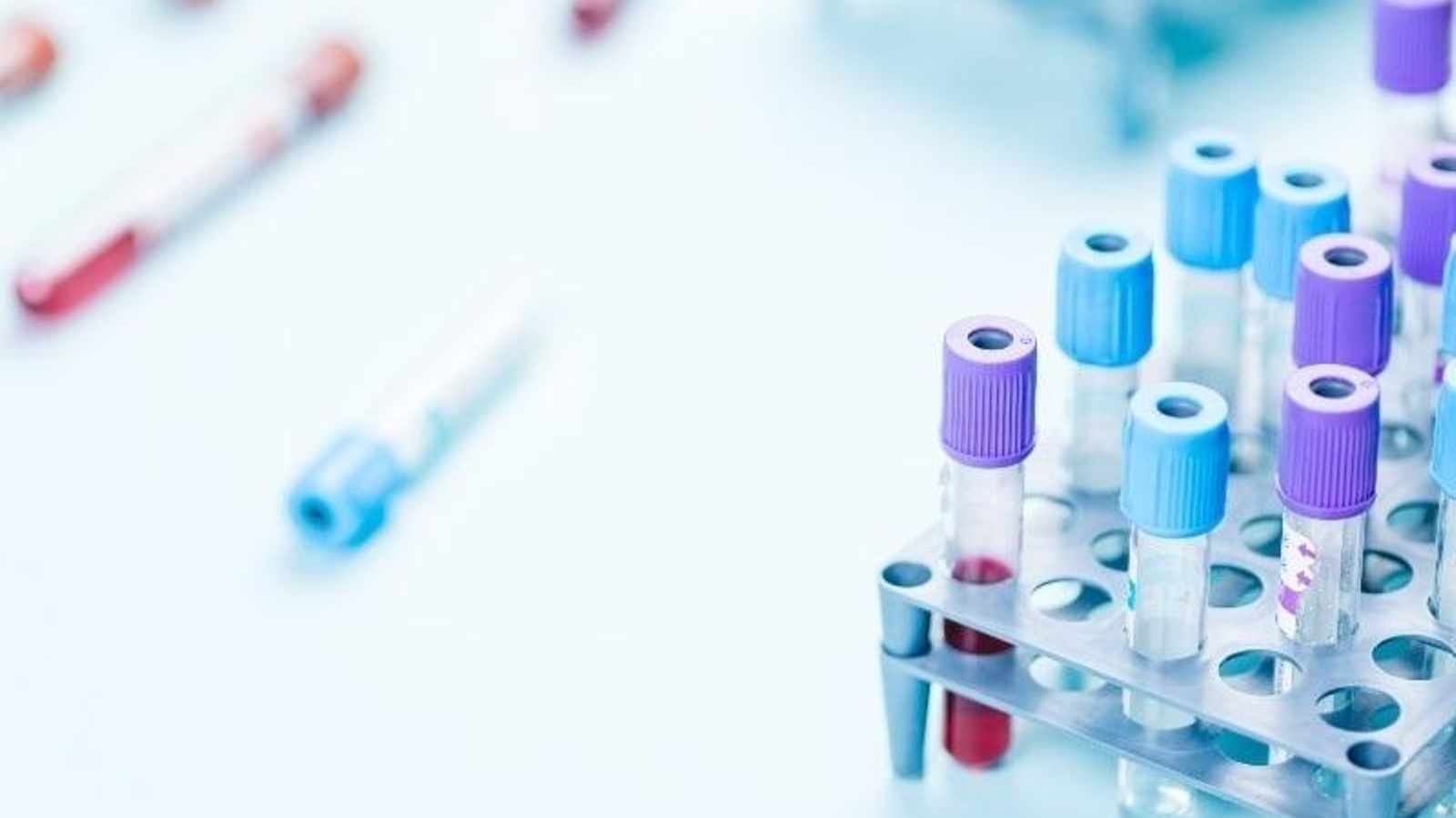 Un laboratori clínic, en una imatge d'arxiu