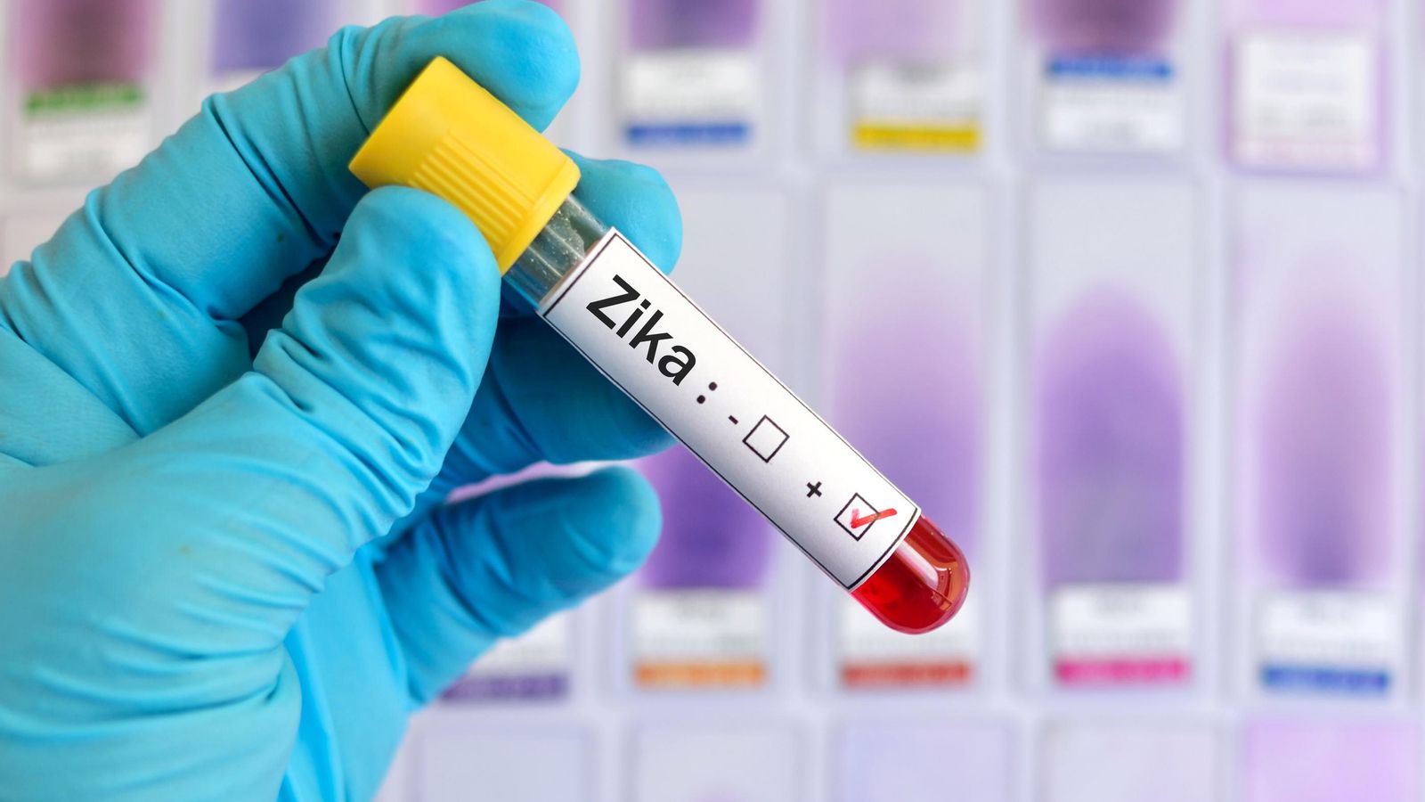 Imatge que recrea una mostra del virus del Zika