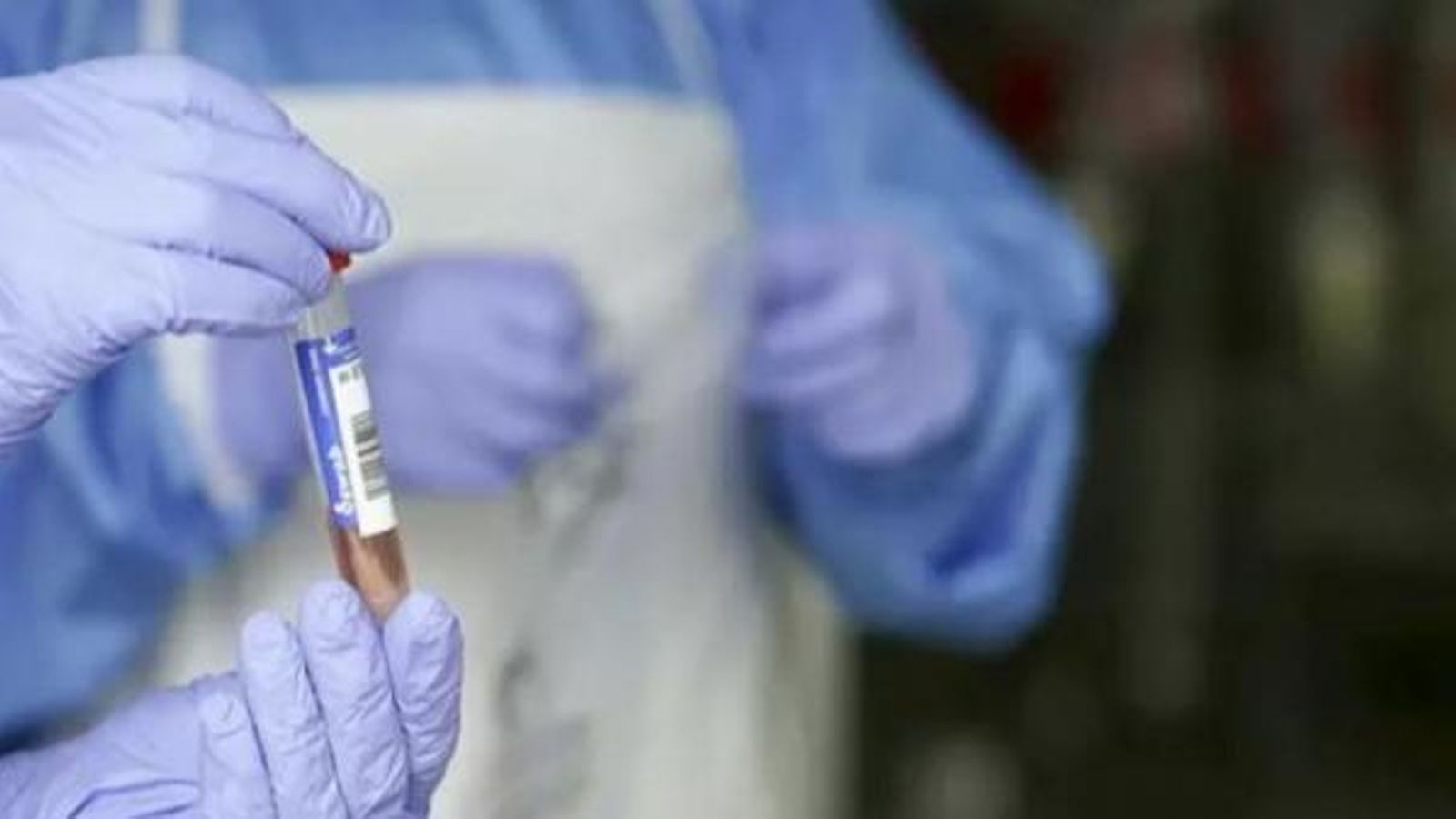 Anàlisi PCR