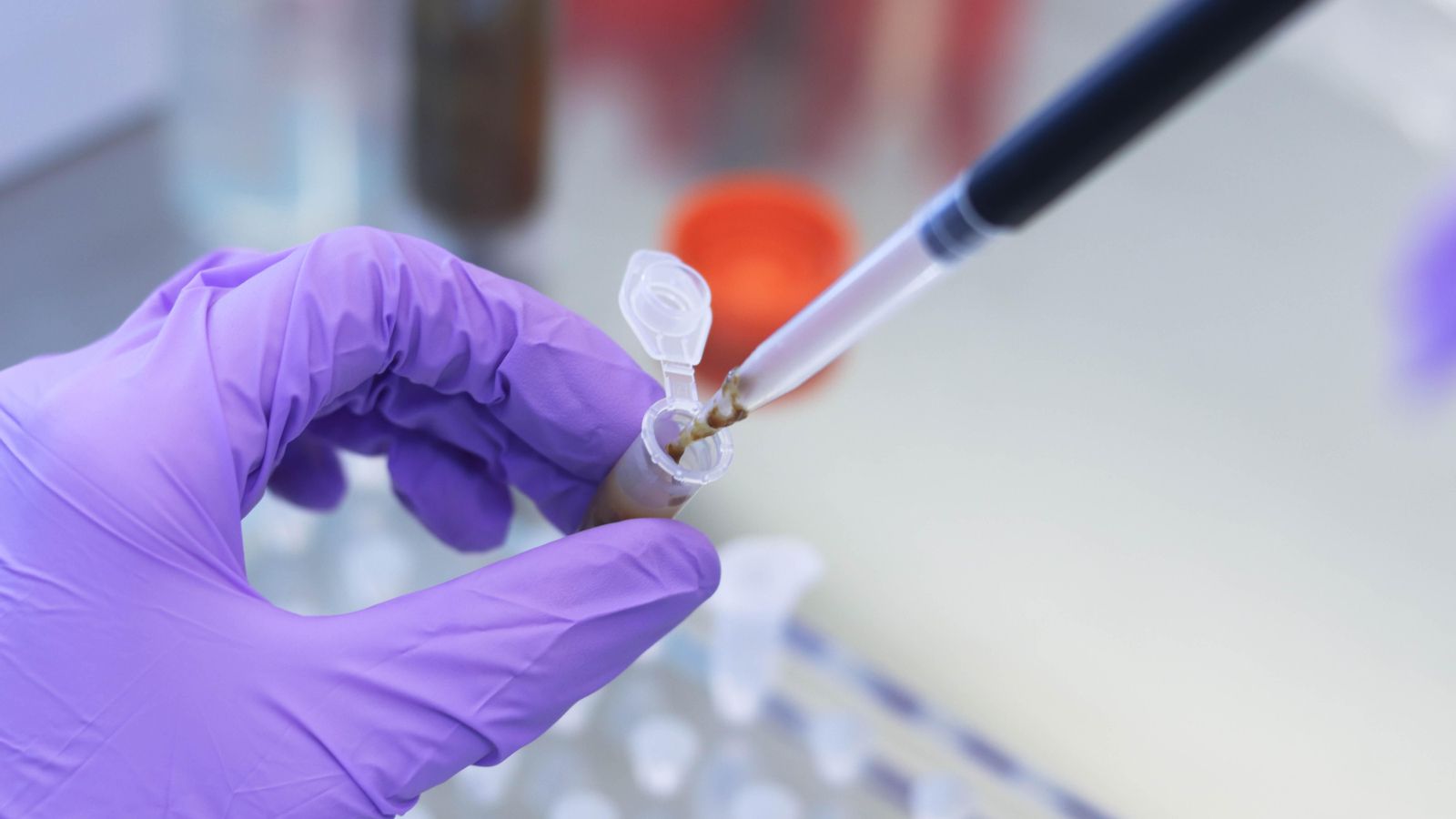 El Test de Sang Oculta en Femta permet la detecció precoç del càncer de colon