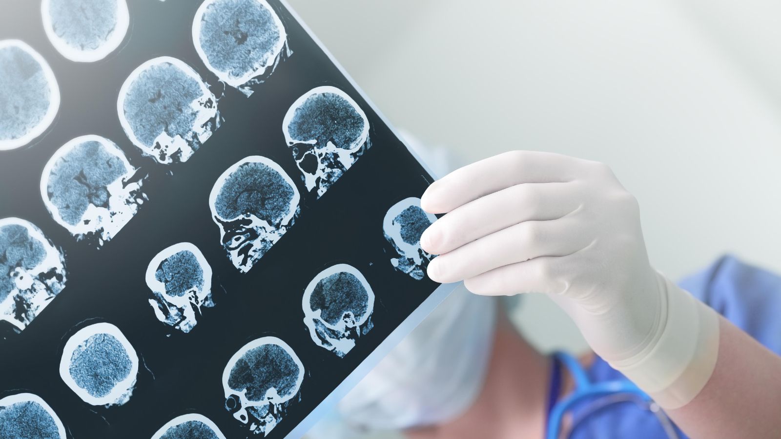 Una metgessa analitza un electroencefalograma d'un pacient Una metgessa analitza un electroencefalograma d'un pacient