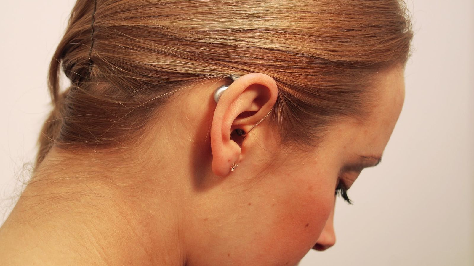 Sanitat retira audiòfons defectuosos per amplificació danyosa