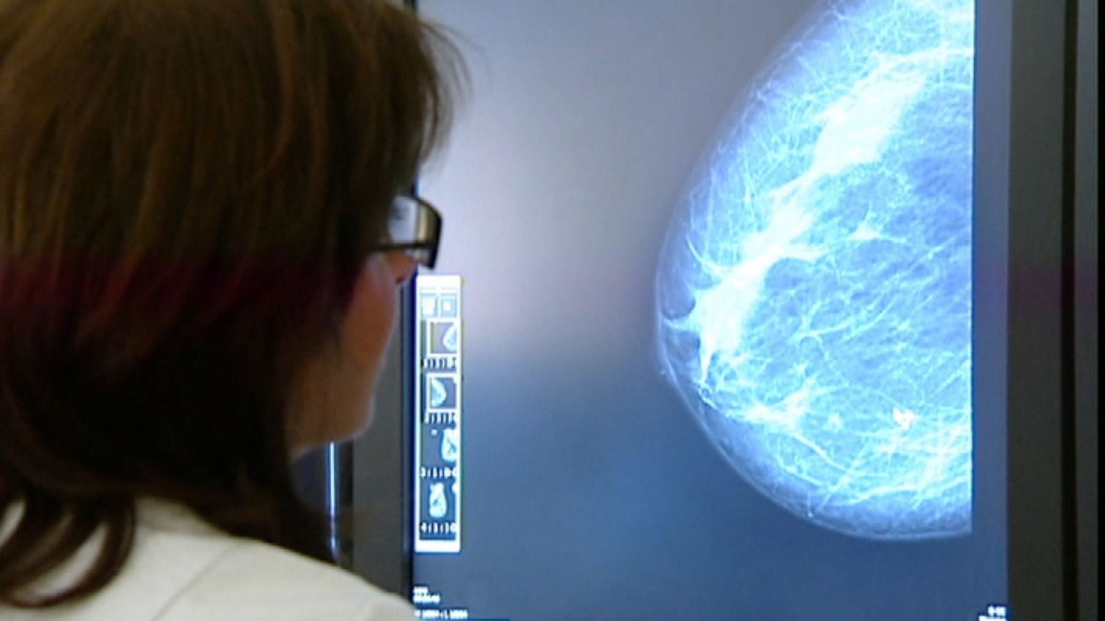 Ampliar el cribratge ajudarà la cobertura del 80% de les dones en risc