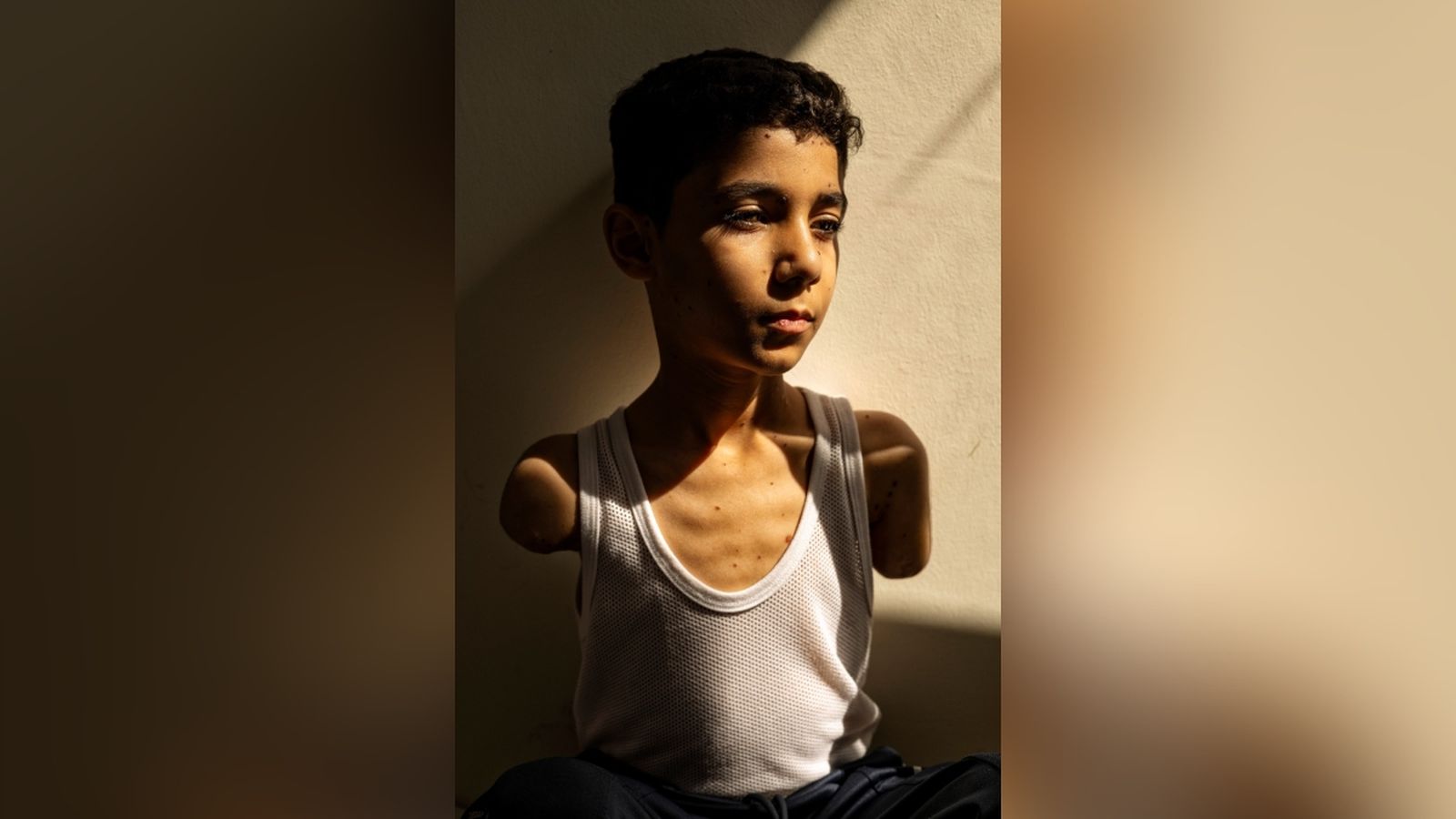 "Mahmoud Ajjour, 9 anys", fotografia guanyadora del World Press Photo