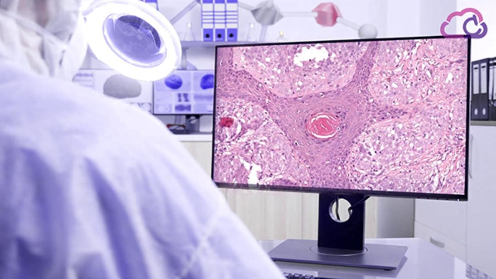 Un investigador treballa en un projecte de diagnòstic de càncer
