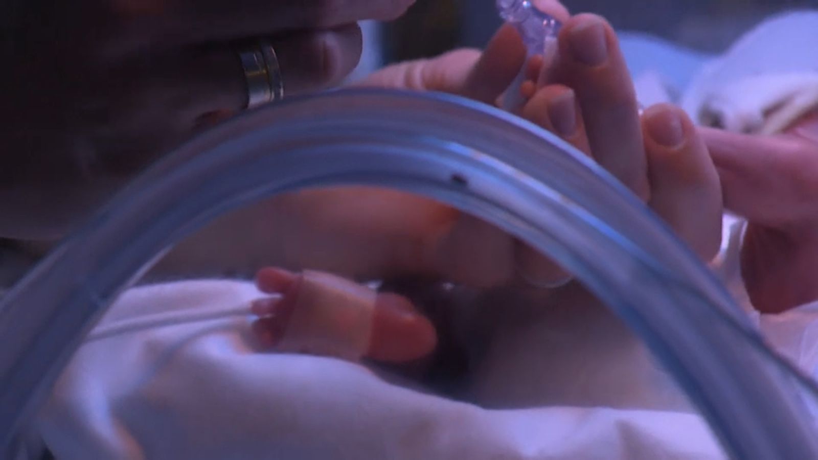 La Fiscalia de Castelló obri diligències per l\'amputació \"per error\" de la cama d\'un nounat