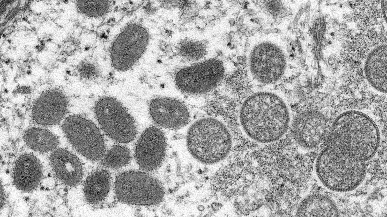 Imatge microscòpica de partícules del virus de la pigota del mico