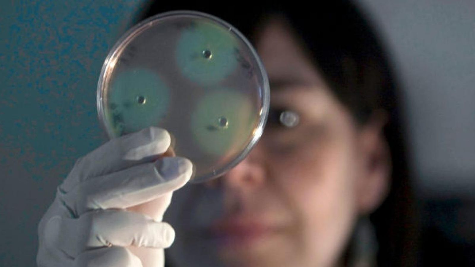 Una científica revisa una mostra de salmonel·la