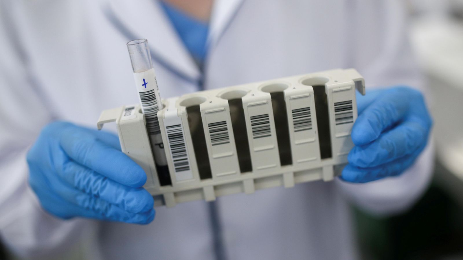 Imatge d'una mostra de SARS-CoV-2 en laboratori