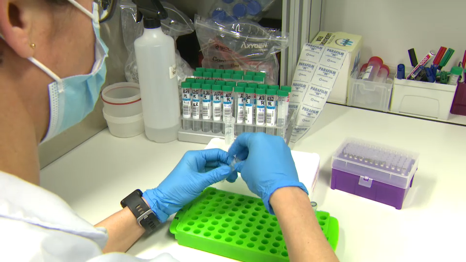 Laboratori valencià que investiga el càncer de pulmó