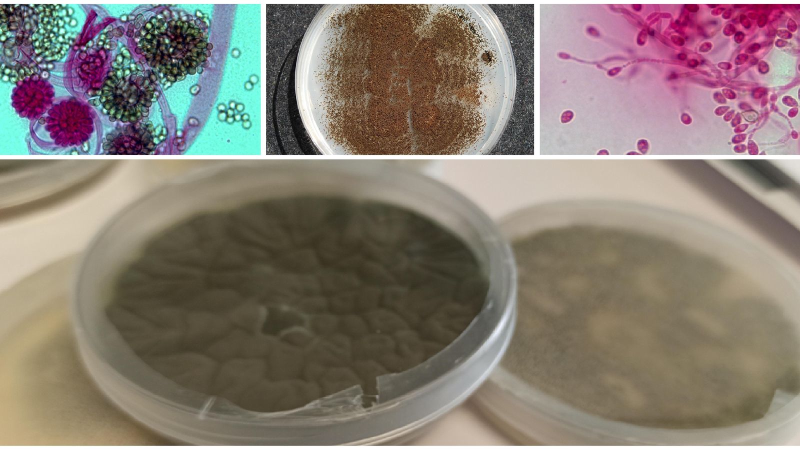 D'esquerra a dreta, mostres dels patògens fúngics, 'Syncephalastrum spp', 'Aspergillus niger' i 'Scedosporium'. Baix, placa d''Aspergillus nidulans' D'esquerra a dreta, mostres dels patògens fúngics, Syncephalastrum spp, Aspergillus Níger i Scedosporium. Baix, placa d'Aspergillus Nidulans
