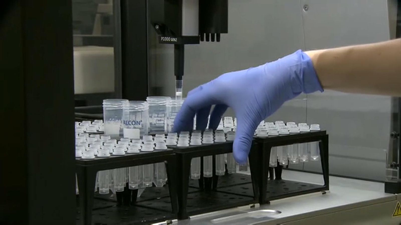 Cinc sanitàries en quarantena pel positiu d'una infermera a l'Hospital de Sant Joan d'Alacant