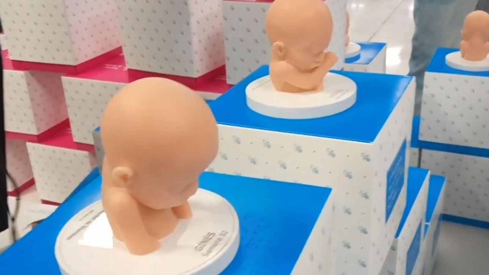 El meu bebé 3D és una figura que es realitza a través de l'ecografia en tres dimensions de la setmana que fa 32 de gestació.