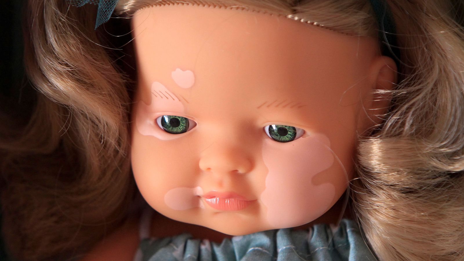 La nina amb vitiligen de Miniland