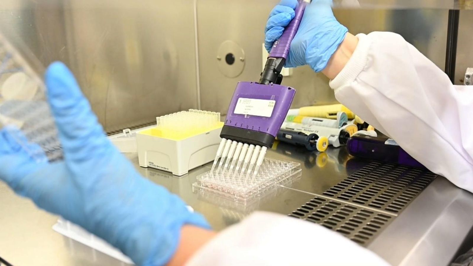 La dona de Barcelona és la primera persona del món a tindre immunitat contra el VIH