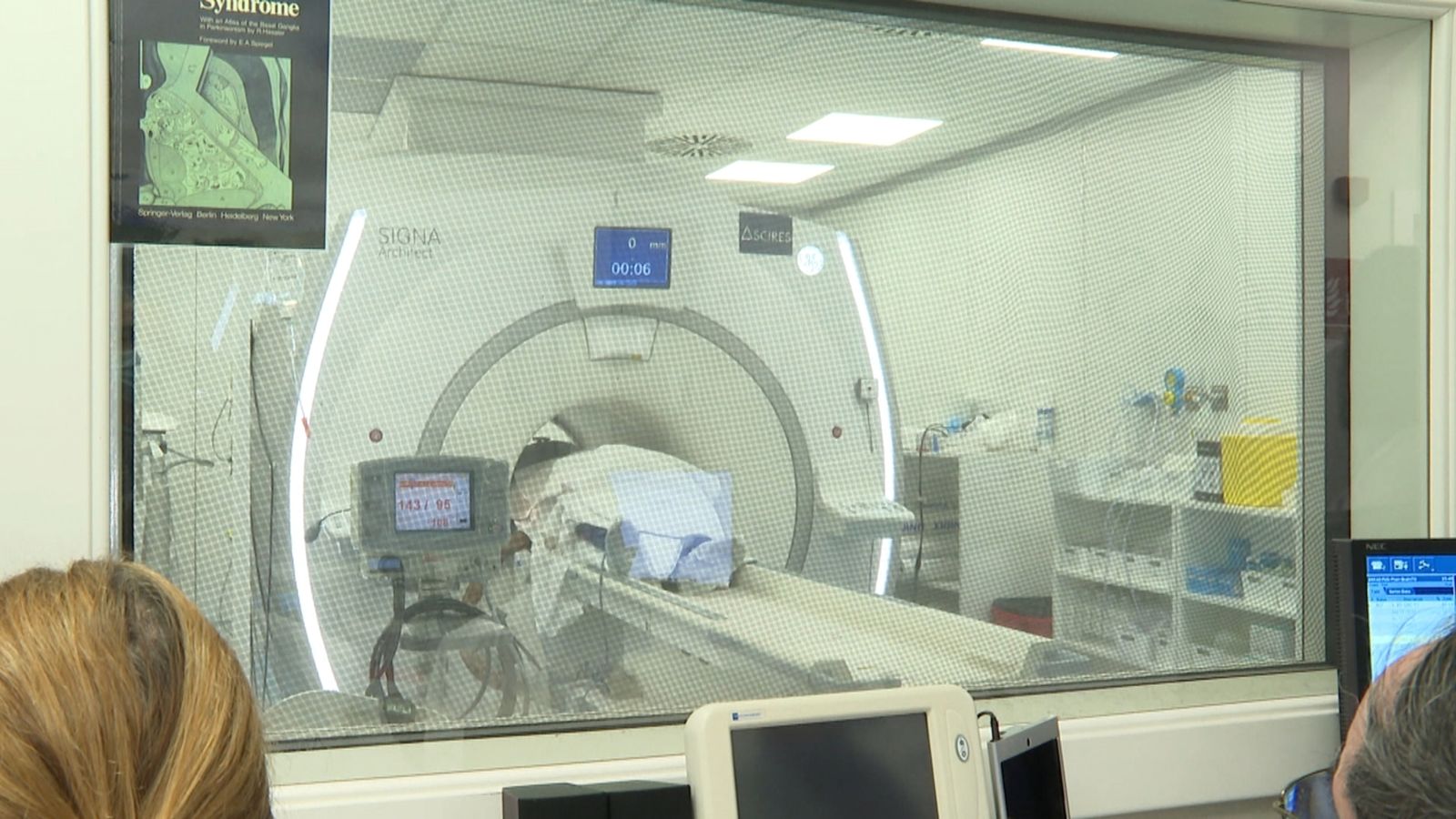 Ultrasons i ressonàncies magnètiques per a combatre el pàrkinson