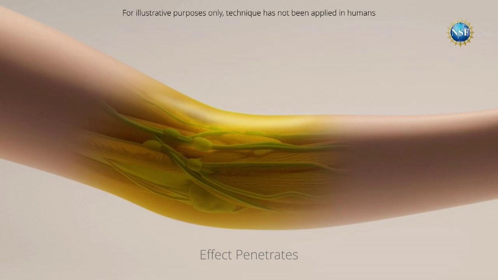 Aspecte que podria tindre la tècnica si s'aplica en humans