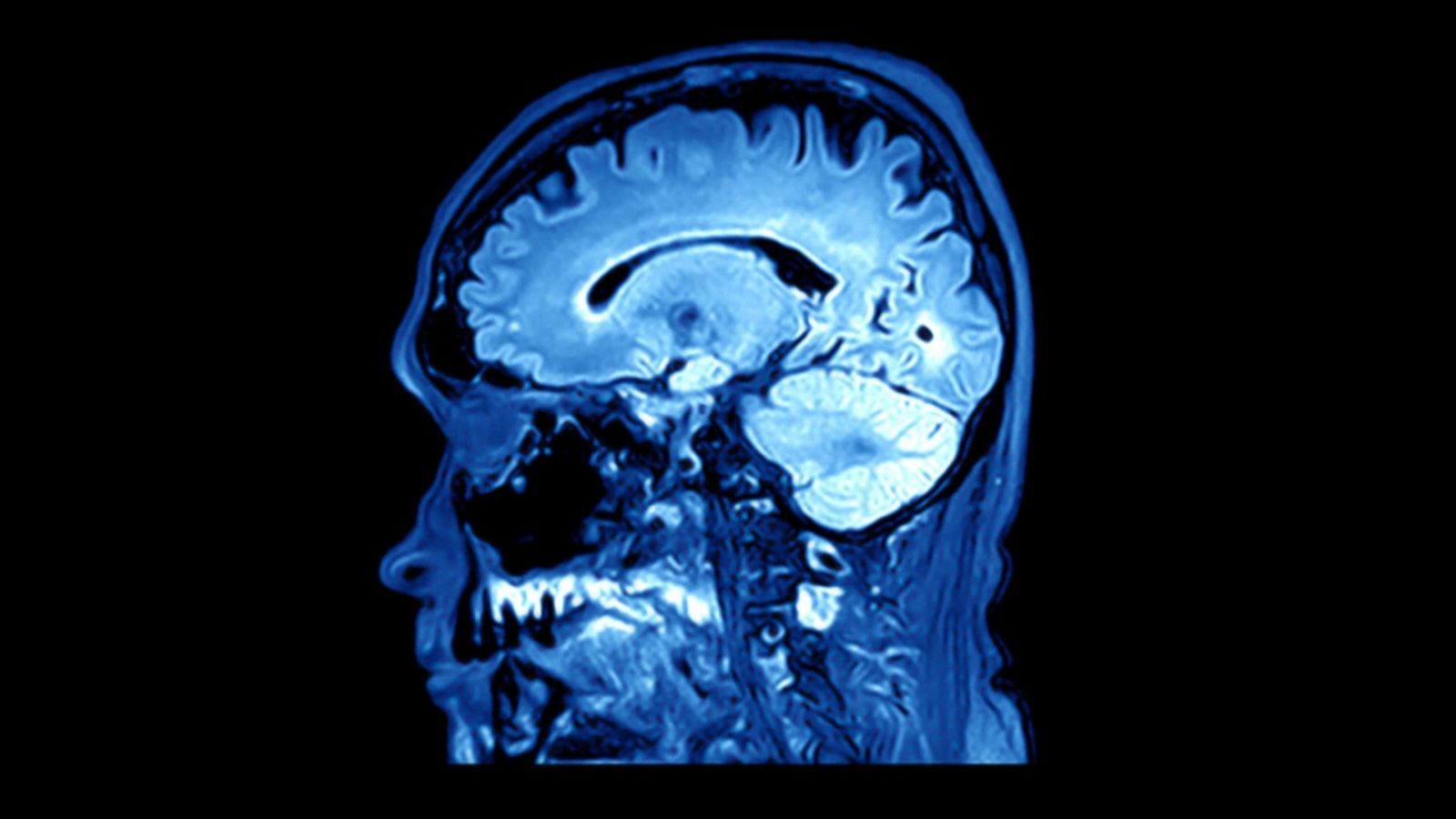 El cervell humà és l'òrgan que genera totes les capacitats cognitives de les persones