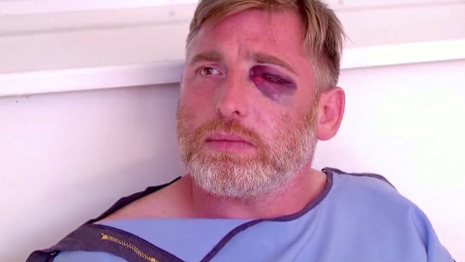 El càmera georgià Alexander Lashkarava atés pels serveis d'emergència després d'un atac LGTBfòbic