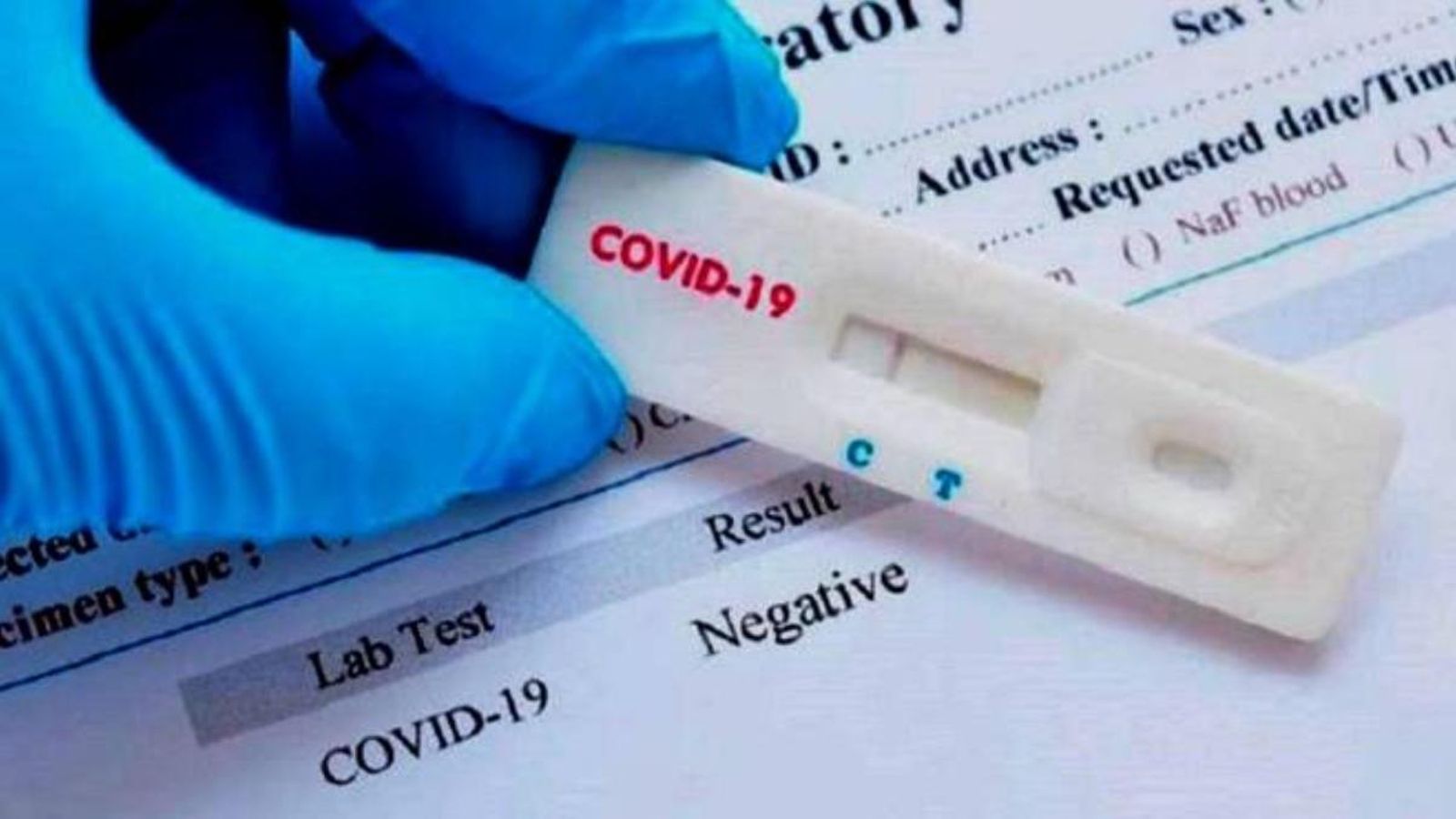 Benidorm farà tests ràpids per a conéixer la situació real de la pandèmia