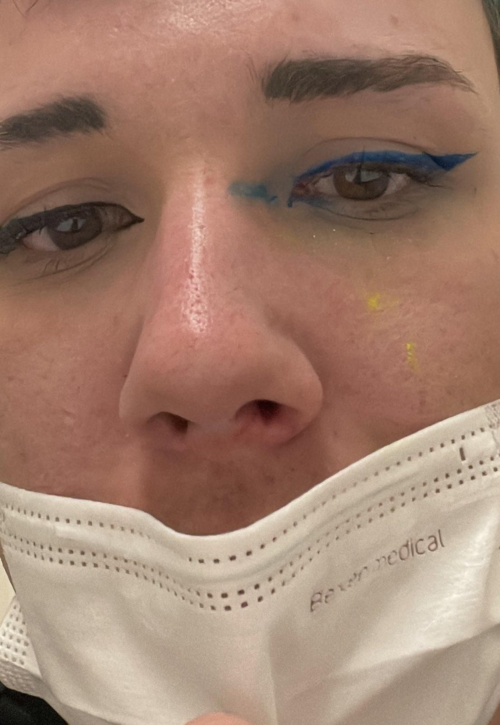 La víctima ha publicat aquesta fotografia posterior a l'agressió en què es pot veure l'ull maquillat