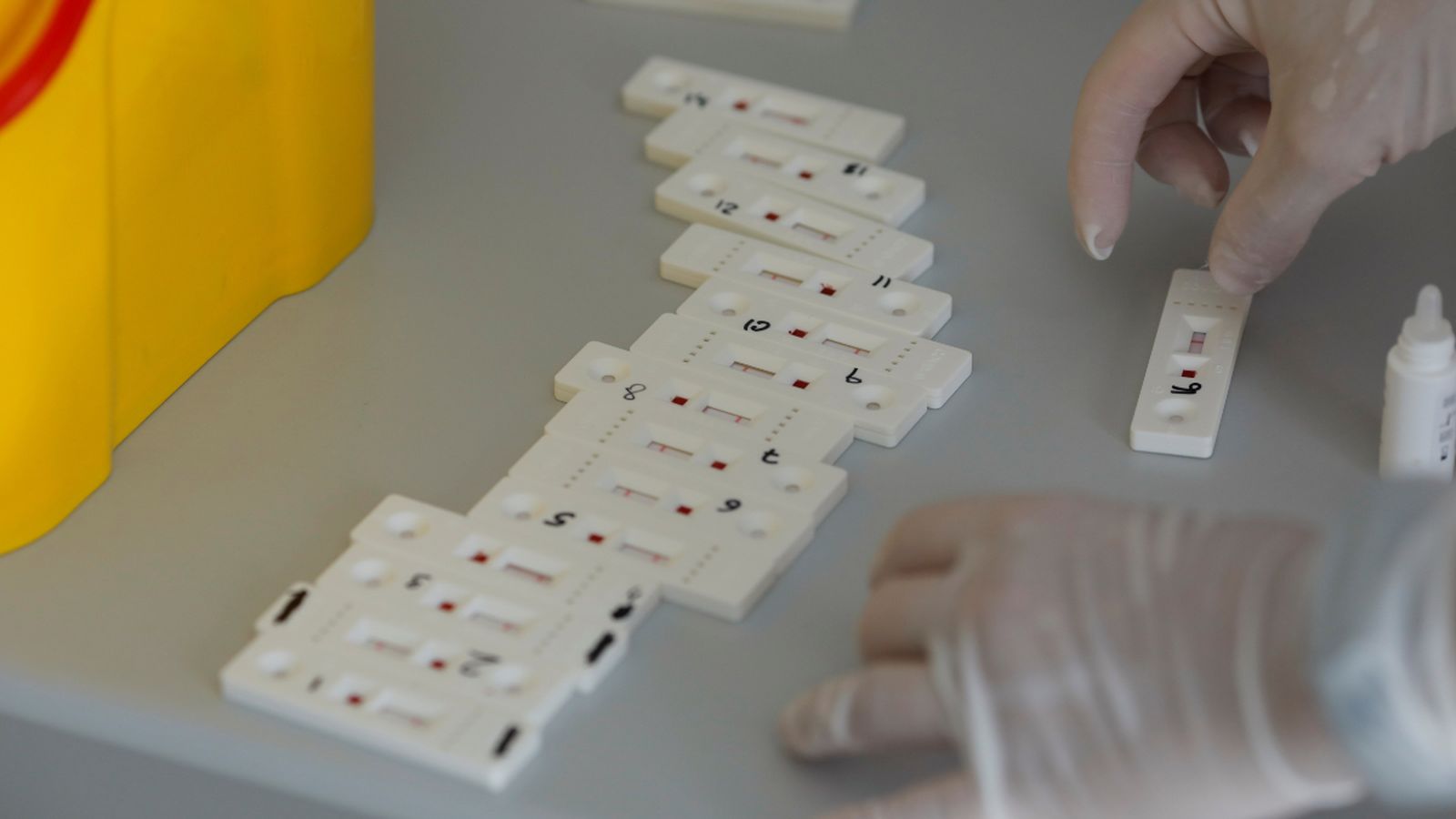 Proves diagnòstiques de Covid-19.