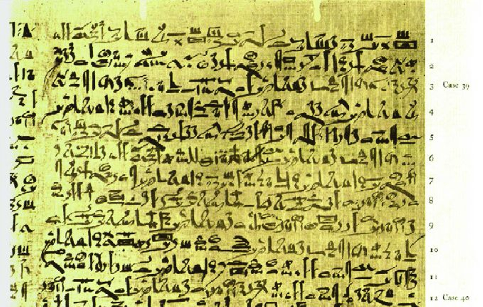 Fragment del papir d’Edwin Smith