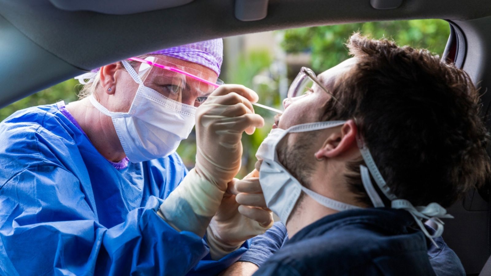 Proves PCR en una imatge d'arxiu