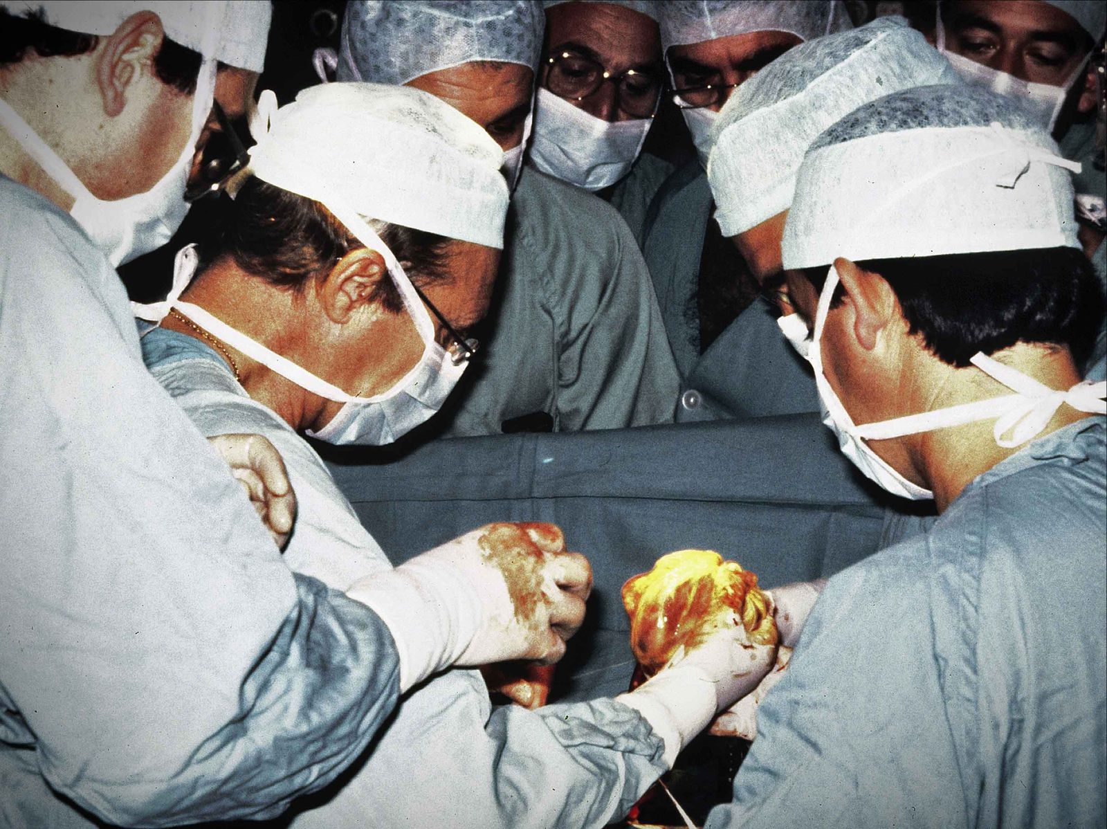 Imatge d'arxiu de la primera interveció cardíaca a la Fe