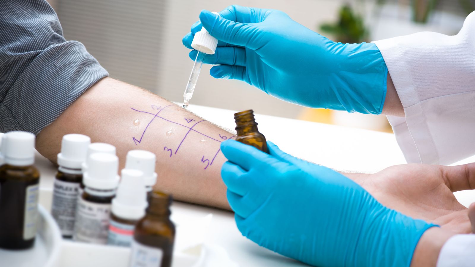 Al·lergòlegs de tot el món reunits a València exigeixen accions immmediates per a millorar la gestió de les malalties al·lèrgiques