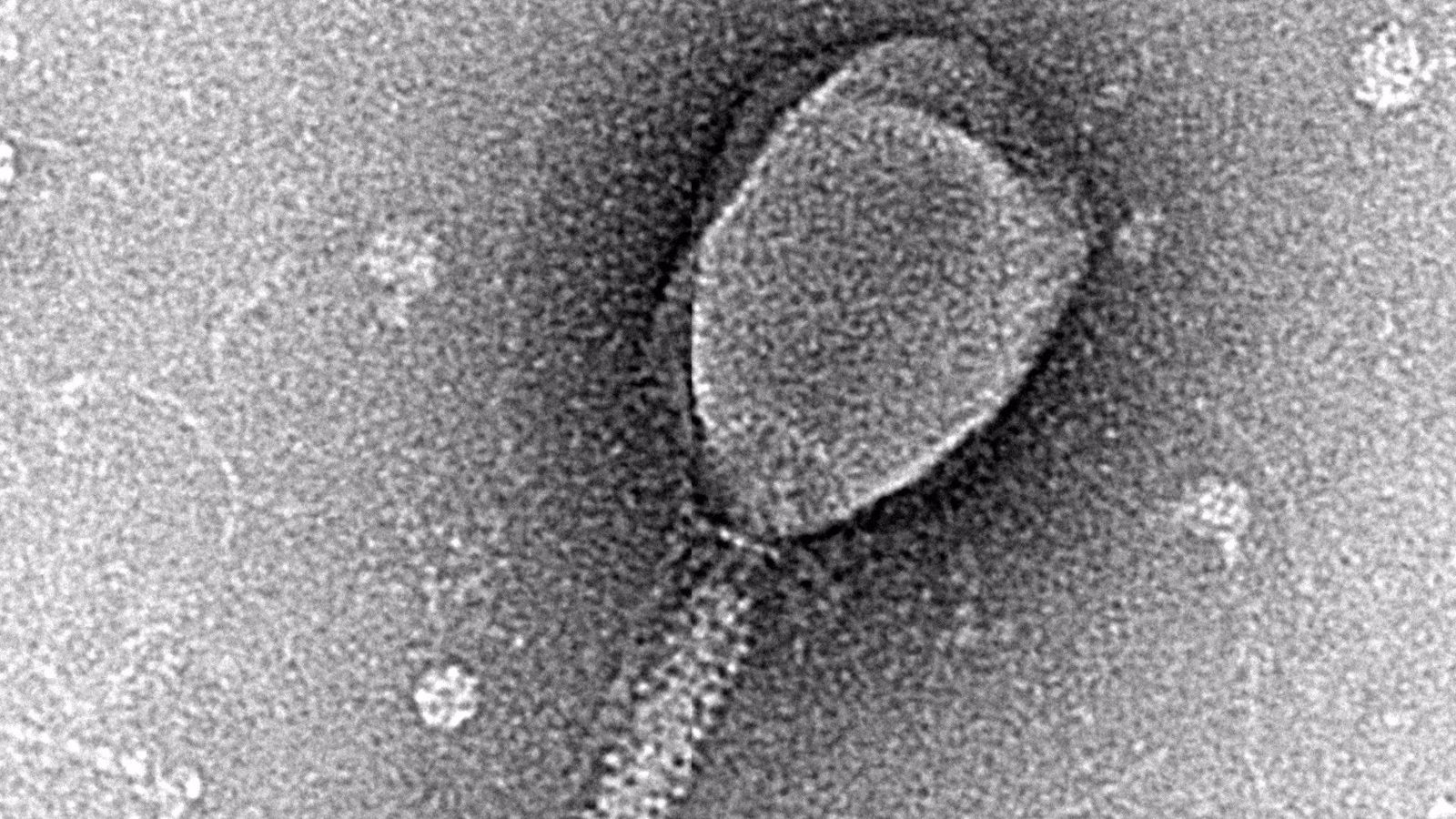 Imatge microscòpica d'una enterobacteria