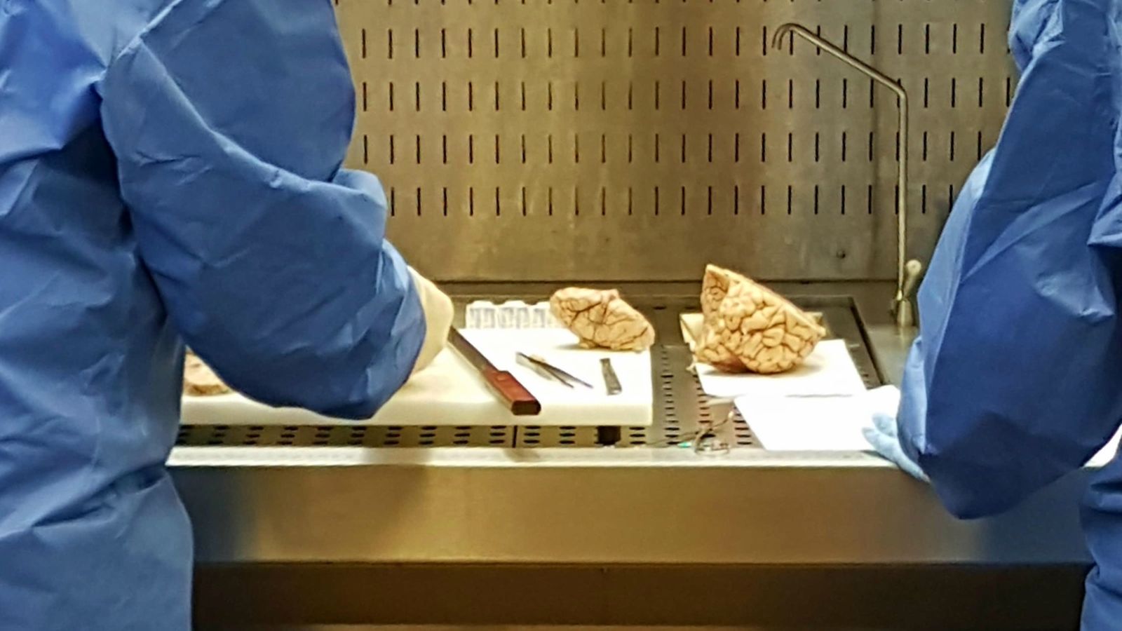 El procés d'extracció, processament i conservació del teixit cerebral ha de ser molt ràpid després del decés