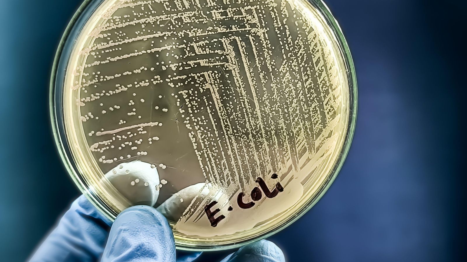 Culiu de la bactèria 'Escherichia coli'