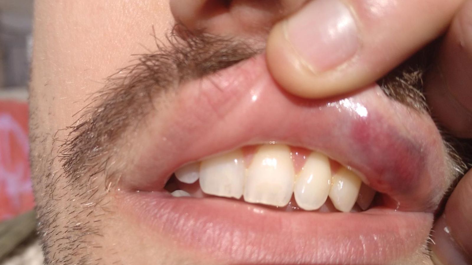 Llavi d'un dels joves agredits