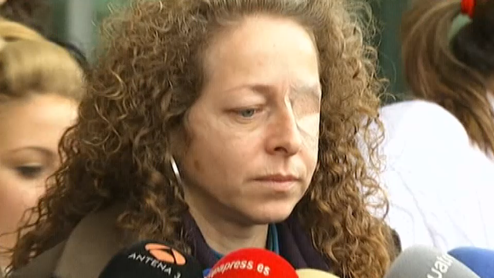 Ester Quintana, una de les persones que va perdre un ull per culpa d'una pilota de goma