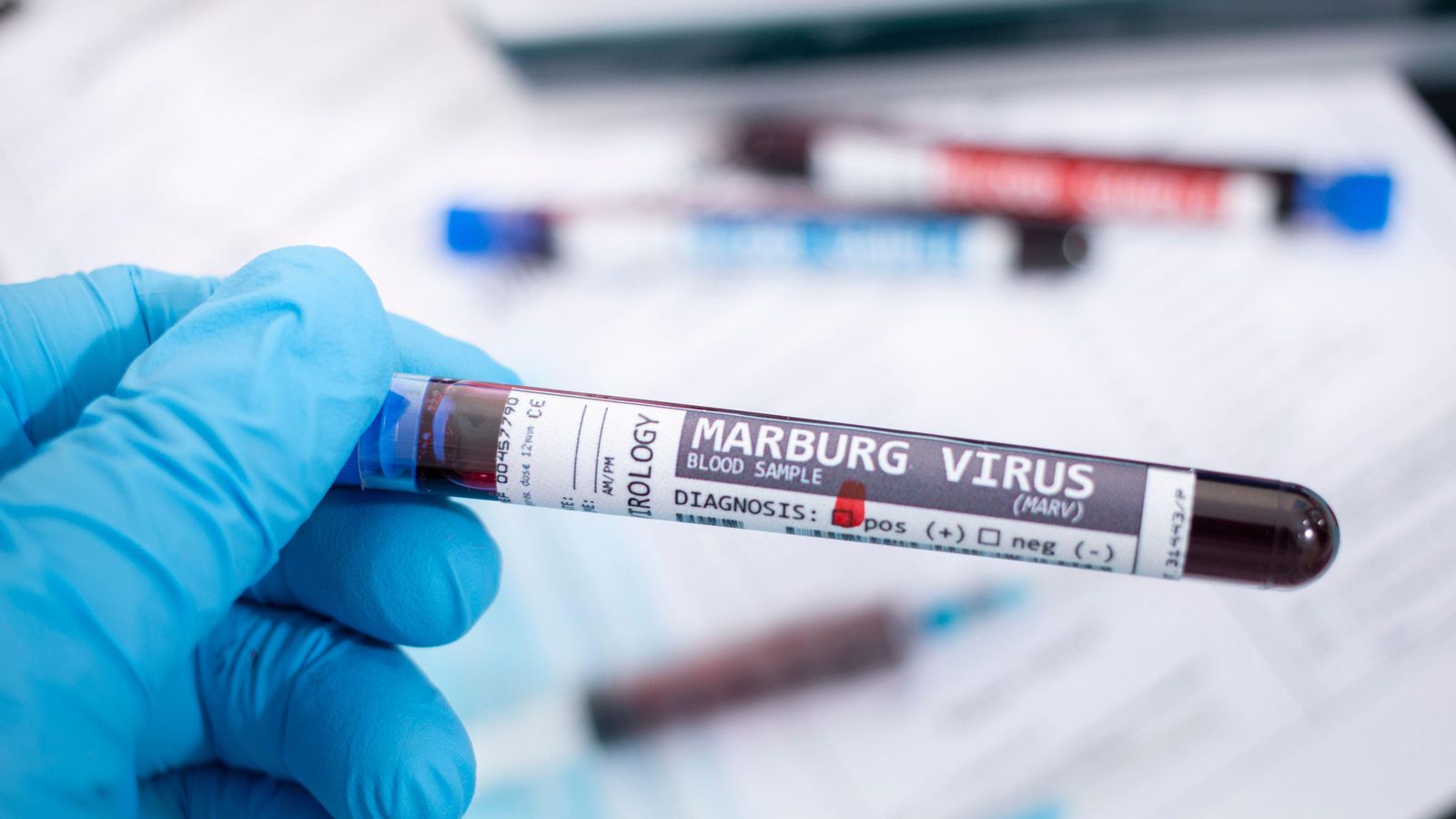 El brot del virus de Marburg va ser detectat el dia 13 de febrer a Guinea Equatorial