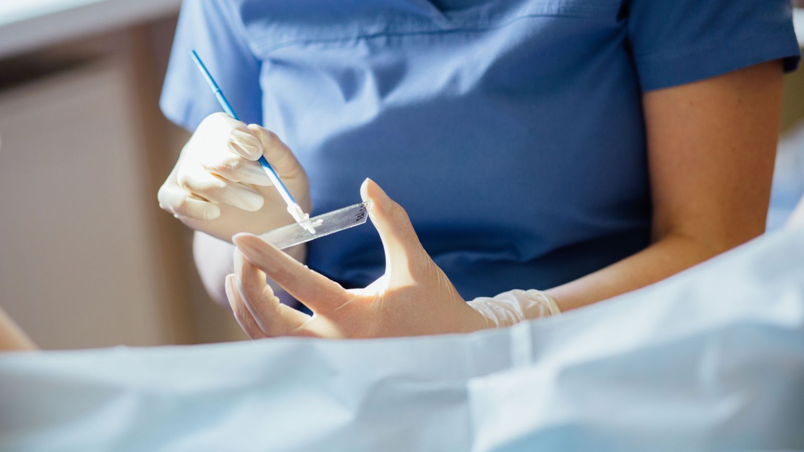 Imatge d'arxiu d'una citologia