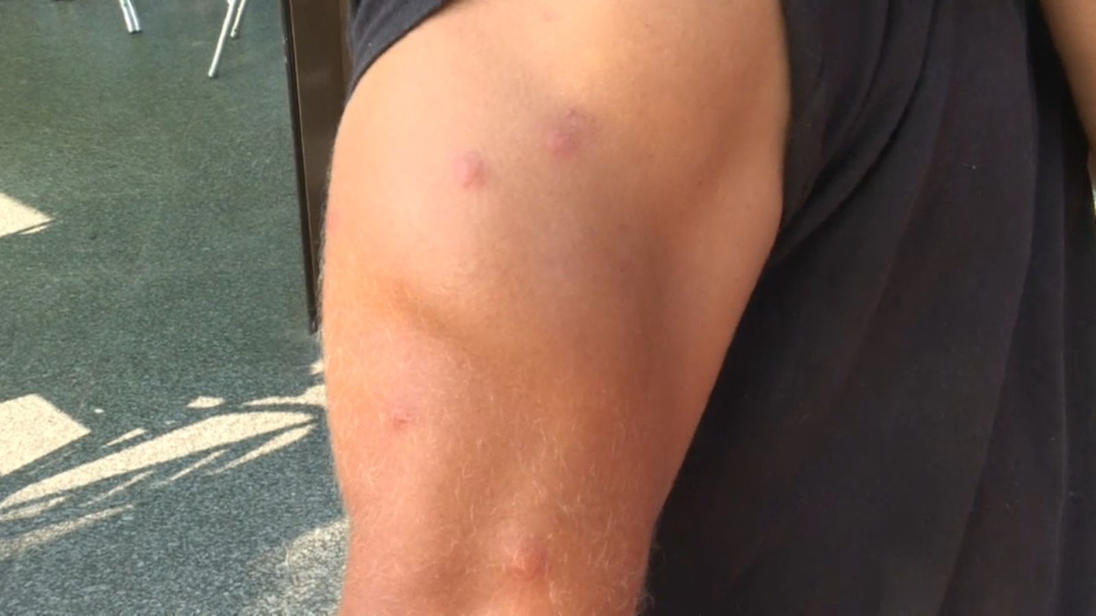 Els experts apunten que enguany disminuirà la transmissió de malalties importades, com ara el Zika, el dengue i la chikungunya, per la crisi turística.