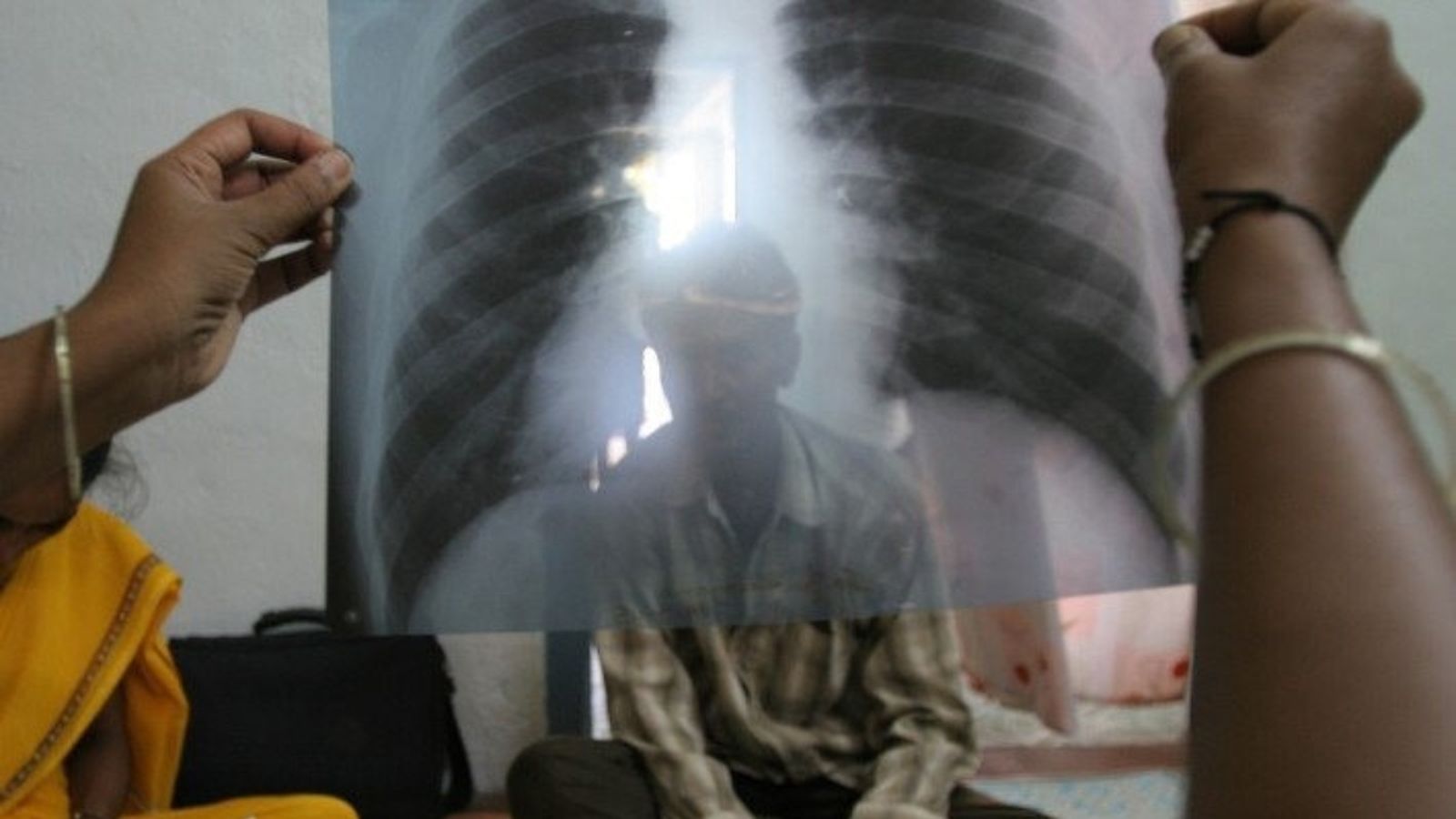 L’OMS reclama una “mobilització sense precedents” a tot el món per a frenar l’avanç de la malaltia