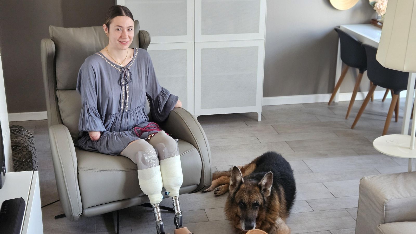 Carla Maronda ha sobreviscut a una infecció per un bacteri que li ha causat seqüeles irreversibles en les extremitats