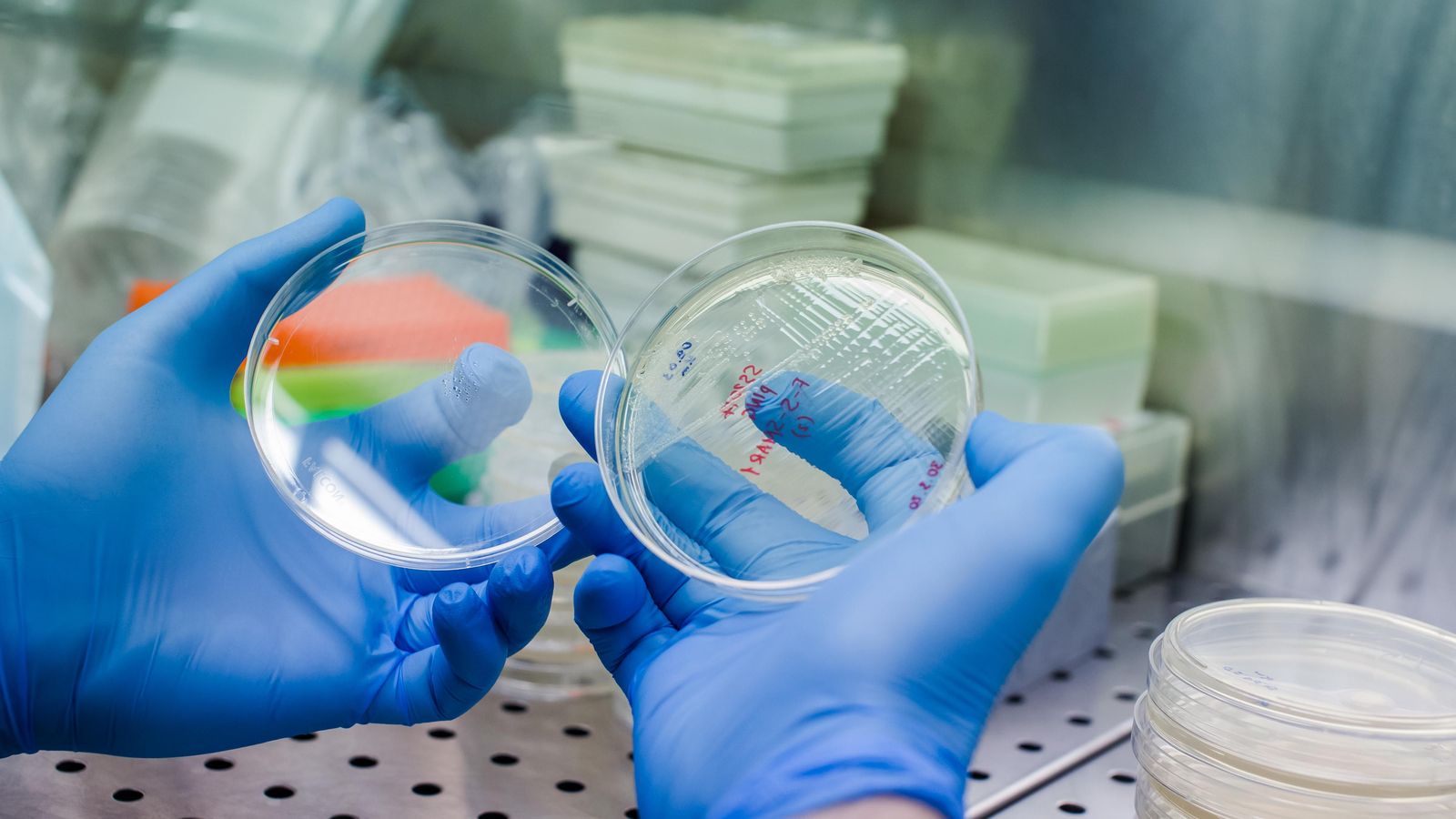 Una placa de Petri per a crear cèl·lules CAR-T (arxiu)