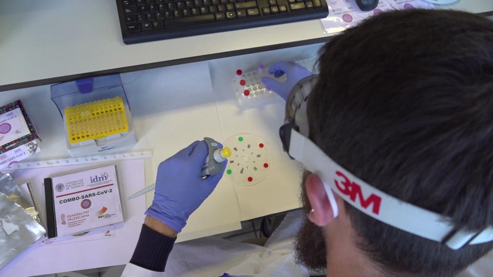 Basat en tecnologies de DVD, detecta anticossos i antígens de SARS-CoV-2 analitzant la mostra serològica o de saliva