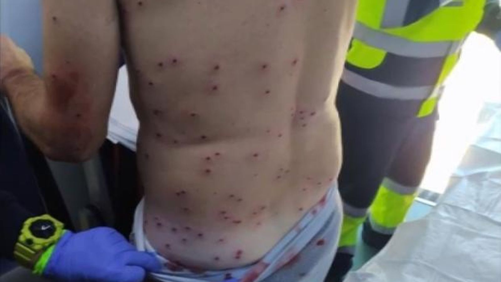 El ciclista va rebre l'impacte de més de 100 perdigons a l'esquena